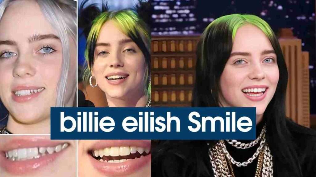 Does billie eilish have braces